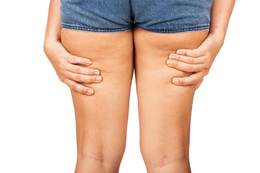 Puede ejercitar la grasa de las piernas Puede ejercitar la grasa de las piernas