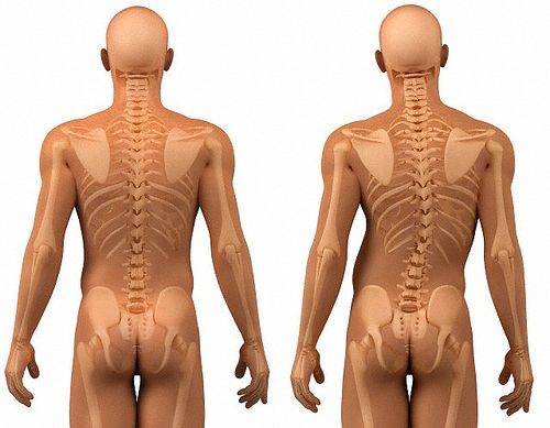 Ejercicios de higiene postural Ejercicios de higiene postural