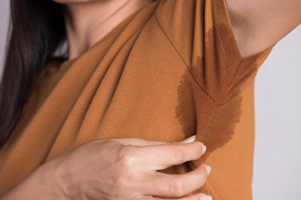 hiperhidrosis
